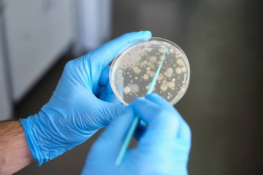 原鑫生物 - 專業大鼠ELISA試劑盒研發公司圖3 原鑫生物 - 專業大鼠ELISA試劑盒研發公司圖3