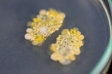 植物elisa試劑盒實驗原理與產品說明簡介 植物elisa試劑盒實驗原理與產品說明簡介