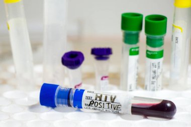 NADH氧化酶活性檢測試劑盒圖1 NADH氧化酶活性檢測試劑盒圖1