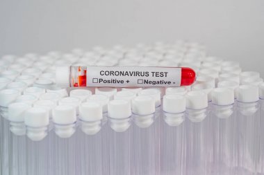 非洲豬瘟病毒熒光PCR核酸檢測(cè)試劑盒圖3 非洲豬瘟病毒熒光PCR核酸檢測(cè)試劑盒圖3