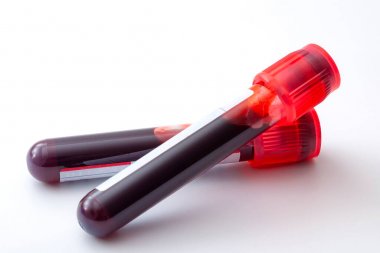 苯胺-4羥化酶活性檢測試劑盒 苯胺-4羥化酶活性檢測試劑盒