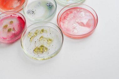 土壤尿酸酶活性檢測試劑盒圖 土壤尿酸酶活性檢測試劑盒圖